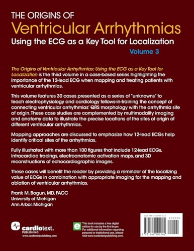 The Origins of Ventricular Arrhythmias: Using the ECG as a Key Tool for Localization