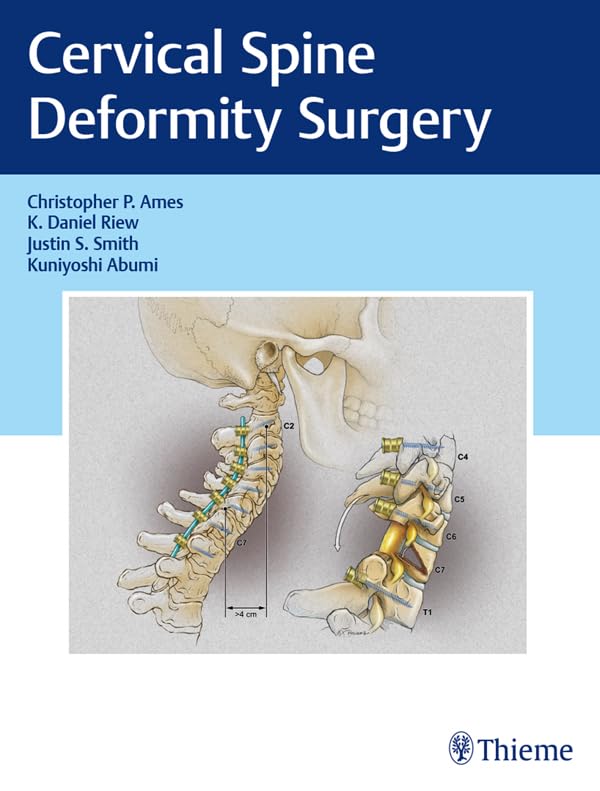 Cervical Spine Deformity Surgery: 1st Edition, Kindle Edition