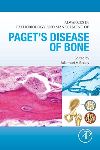 Advances in Pathobiology and Management of Paget's Disease of Bone: 1st Edition