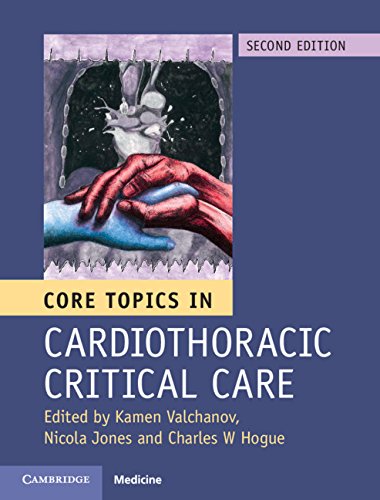 Core Topics in Cardiothoracic Critical Care: 2nd Edition, Kindle Edition