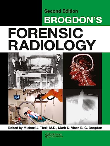 Brogdon's Forensic Radiology: 2nd Edition