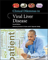 Clinical Dilemmas in Viral Liver Disease (Clinical Dilemmas (UK)): 2nd Edition