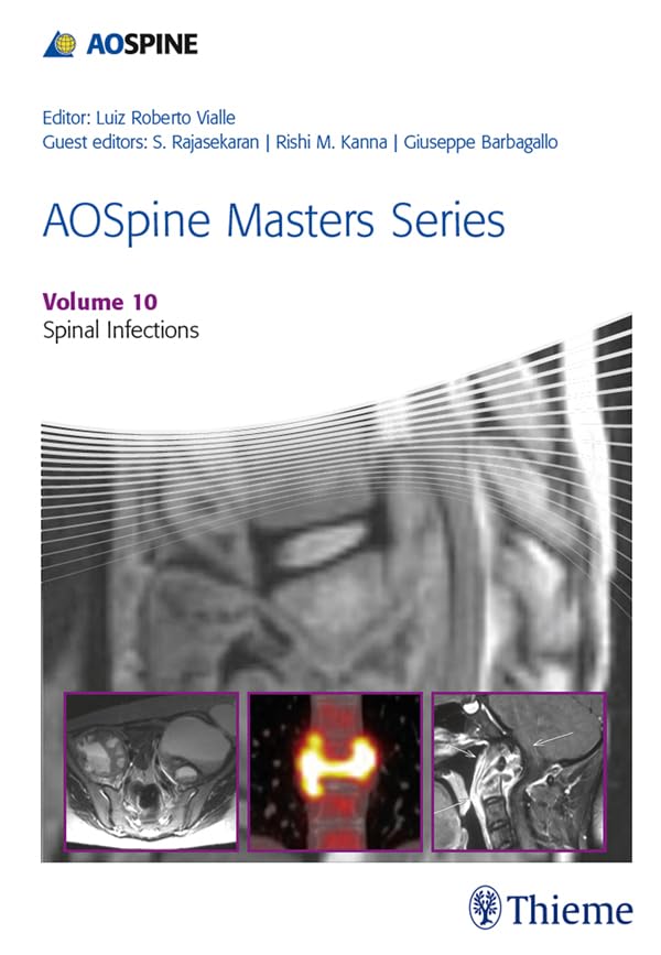 AOSpine Masters Series, Volume 10: Spinal Infections: 1st Edition, Kindle Edition