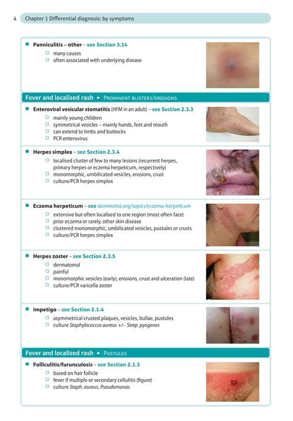 Dermatology Made Easy, second edition