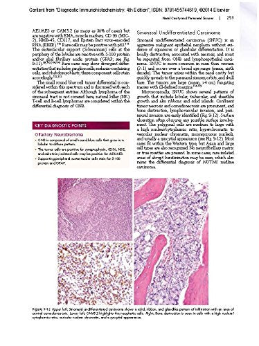 Diagnostic Immunohistochemistry: Theranostic and Genomic Applications, Expert Consult: Online and Print