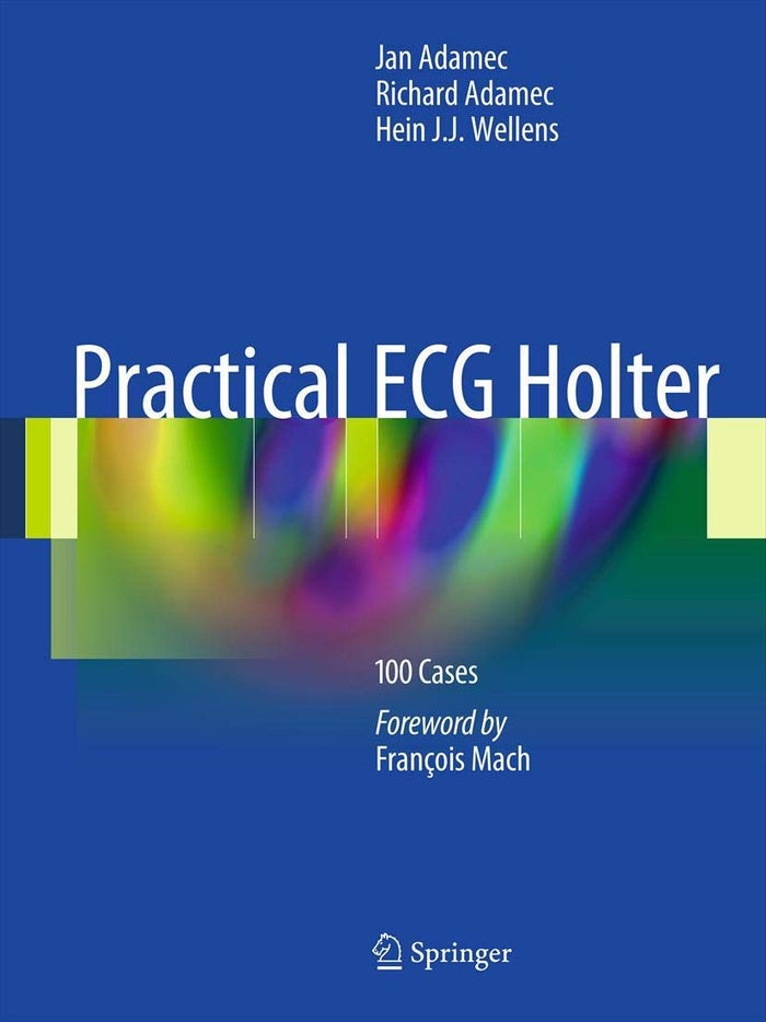 Practical ECG Holter: 100 Cases