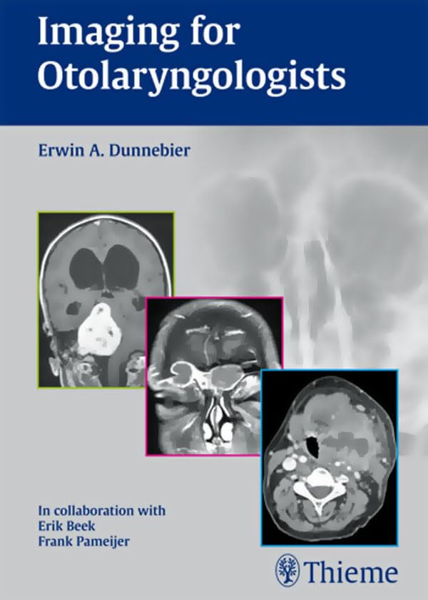 Imaging for Otolaryngologists: 1st Edition