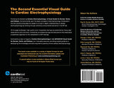 Cardiac Electrophysiology 2: An Advanced Visual Guide for Nurses, Techs, and Fellows