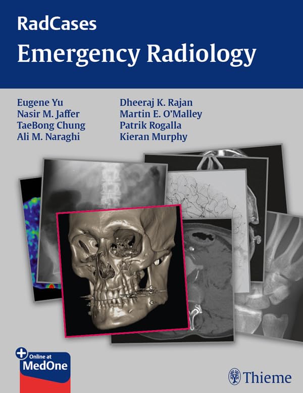 Radcases Emergency Radiology (Radcases Plus Q&A): 1st Edition