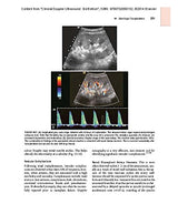 Clinical Doppler Ultrasound: Expert Consult: Online and Print