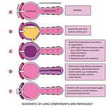 Clinical Pathophysiology Made Ridiculously Simple: Color Edition