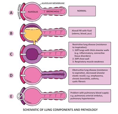 Clinical Pathophysiology Made Ridiculously Simple: Color Edition