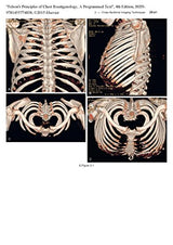 Felson's Principles of Chest Roentgenology, A Programmed Text: 4th Edition