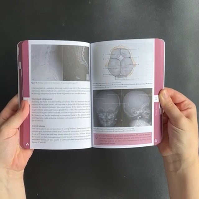 Pocket Radiology: An essential pocket-sized book on diagnostic imaging and radiographic findings. (Compendium Medicine)