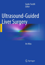 Ultrasound-Guided Liver Surgery: An Atlas