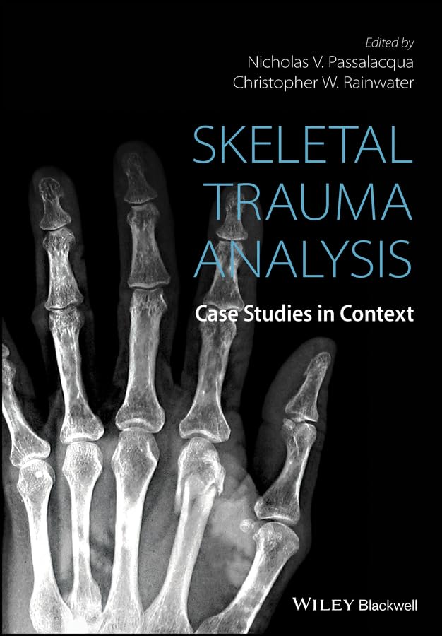 Skeletal Trauma Analysis: Case Studies in Context