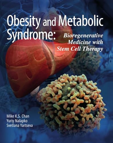 Obesity and Metabolic Syndrome: Bioregenerative Medicine with Stem Cell Therapy