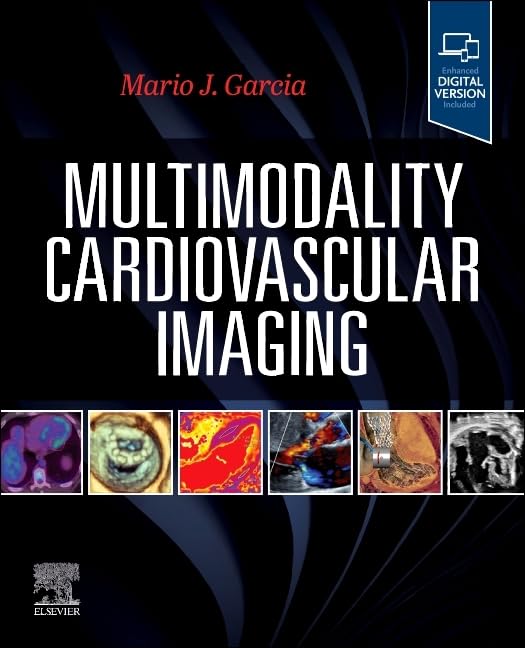 Multimodality Cardiovascular Imaging: 1st Edition