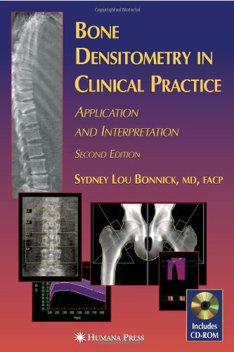 Bone Densitometry in Clinical Practice: Application and Interpretation (Current Clinical Practice)