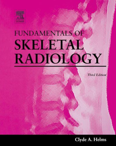 Fundamentals of Skeletal Radiology: 3rd Edition