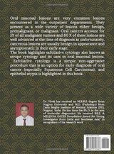 Cytology in Diagnosis Oral Lesions