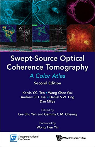 Swept-source Optical Coherence Tomography: A Color Atlas (Second Edition): A Color Atlas: Second Edition, Kindle Edition