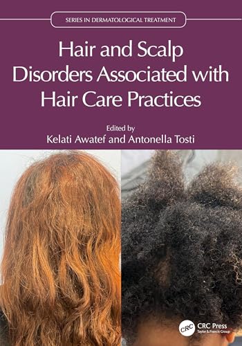 Hair and Scalp Disorders Associated with Hair Care Practices (Series in Dermatological Treatment): 1st Edition