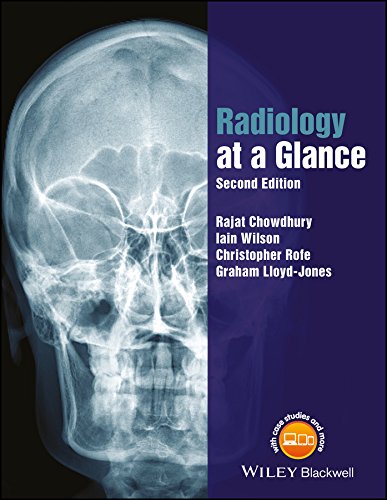 Radiology at a Glance: 2nd Edition