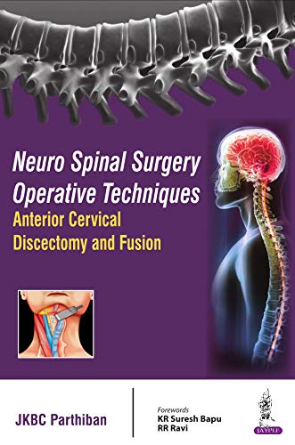 Anterior Cervical Discectomy and Fusion: 1st Edition, Kindle Edition