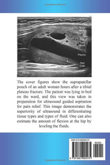 Musculoskeletal Ultrasound for the Orthopaedic Surgeon Volume 2: ER, OR and Clinic (Musculoskeletal Ultrasound Series)
