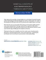 Essential Concepts of Electrophysiology Through Case Studies: Intracardiac EGMs