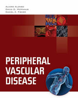 Peripheral Vascular Disease:.