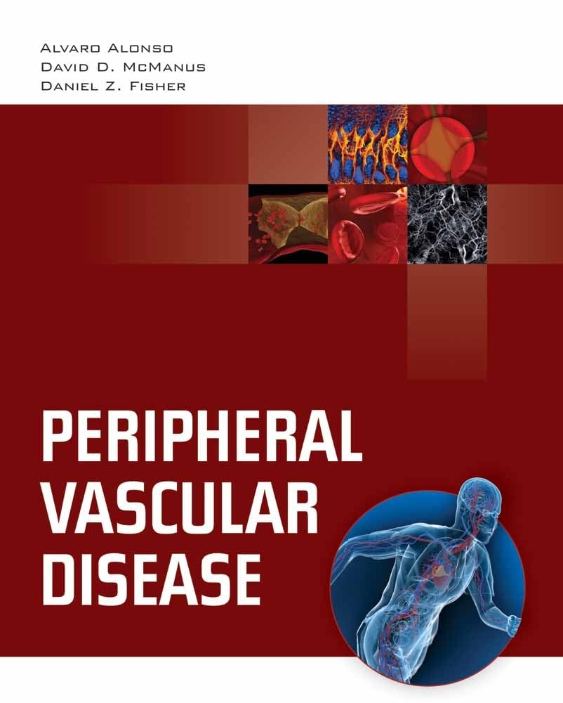 Peripheral Vascular Disease:.