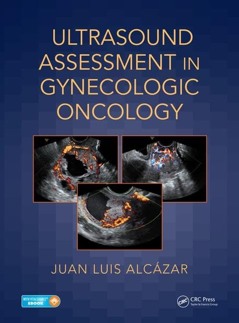 Ultrasound Assessment in Gynecologic Oncology: 1st Edition