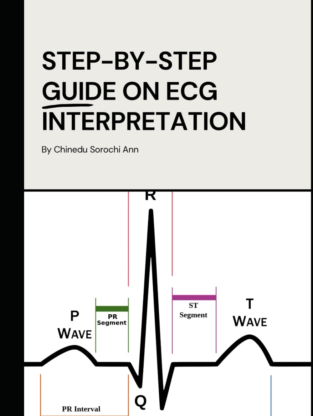 Step-By-Step Guide On ECG Interpretation: A Simplified Step-by-Step Clinical Guide to ECG Interpretation and Cardiovascular Drug Management
