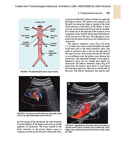 Clinical Doppler Ultrasound: Expert Consult: Online and Print