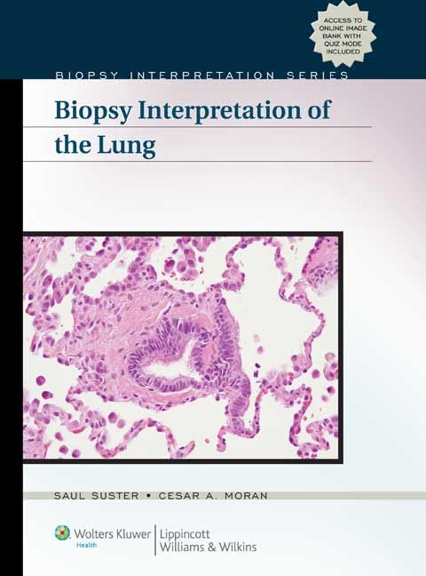 Biopsy Interpretation of the Lung: 1st Edition