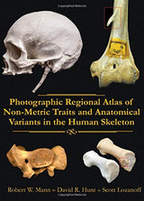 Photographic Regional Atlas of Non-Metric Traits and Anatomical Variants in the Human Skeleton: 1st Edition