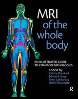 MRI of the Whole Body: An Illustrated Guide for Common Pathologies: 1/E Edition