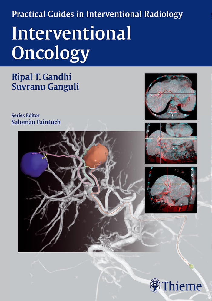 Interventional Oncology (Practical Guides in Interventional Radiology): Illustrated Edition