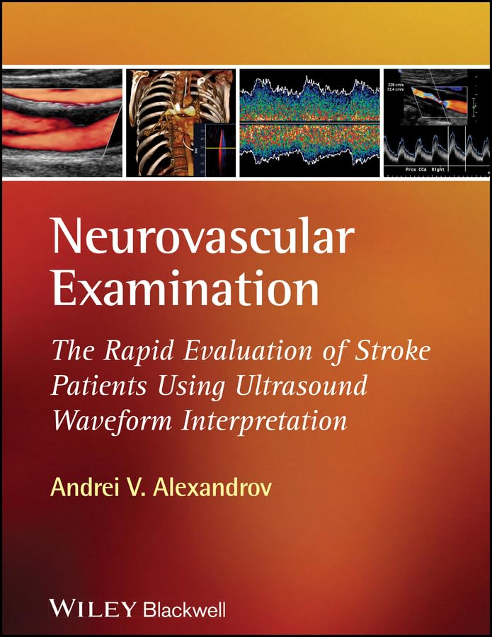 Neurovascular Examination: The Rapid Evaluation of Stroke Patients Using Ultrasound Waveform Interpretation