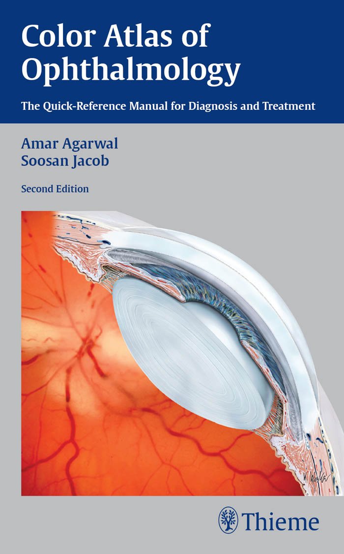 Color Atlas of Ophthalmology: The Quick-Reference Manual for Diagnosis and Treatment: 2nd Edition, Kindle Edition