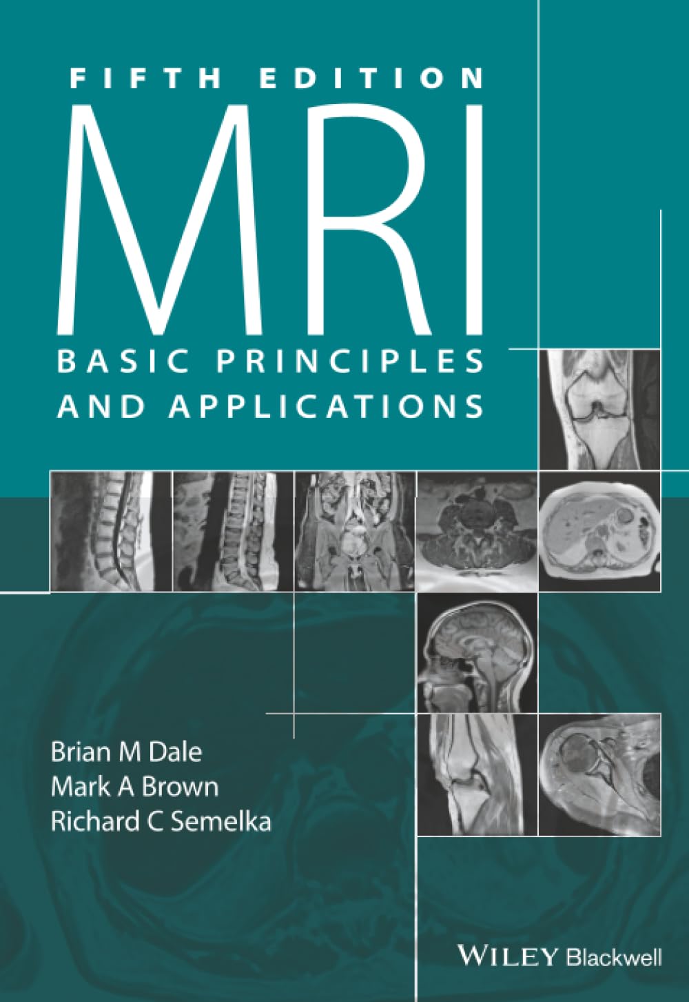 MRI: Basic Principles and Applications