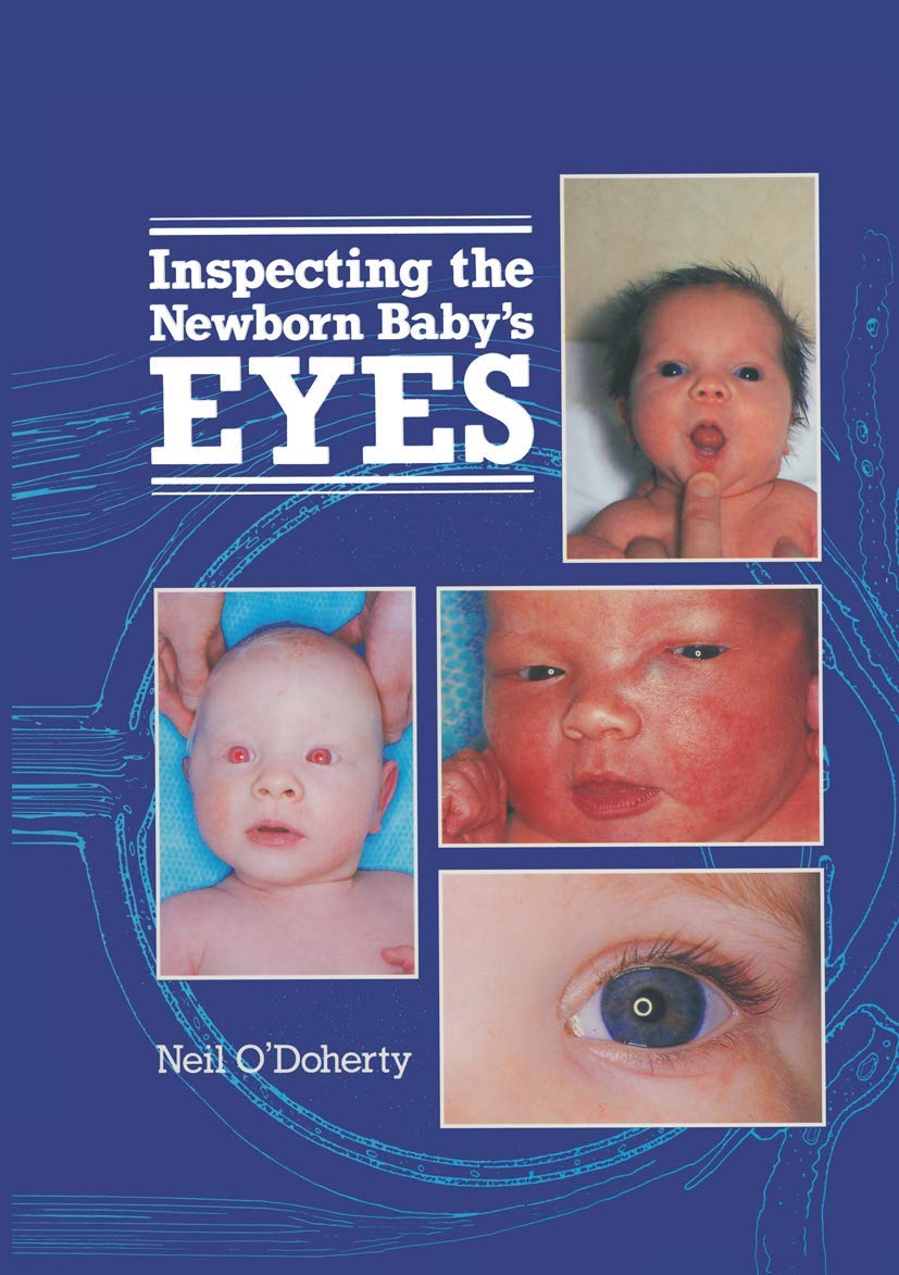 Inspecting the Newborn Baby's Eyes (Atlases of Childhood Series): 1st Edition