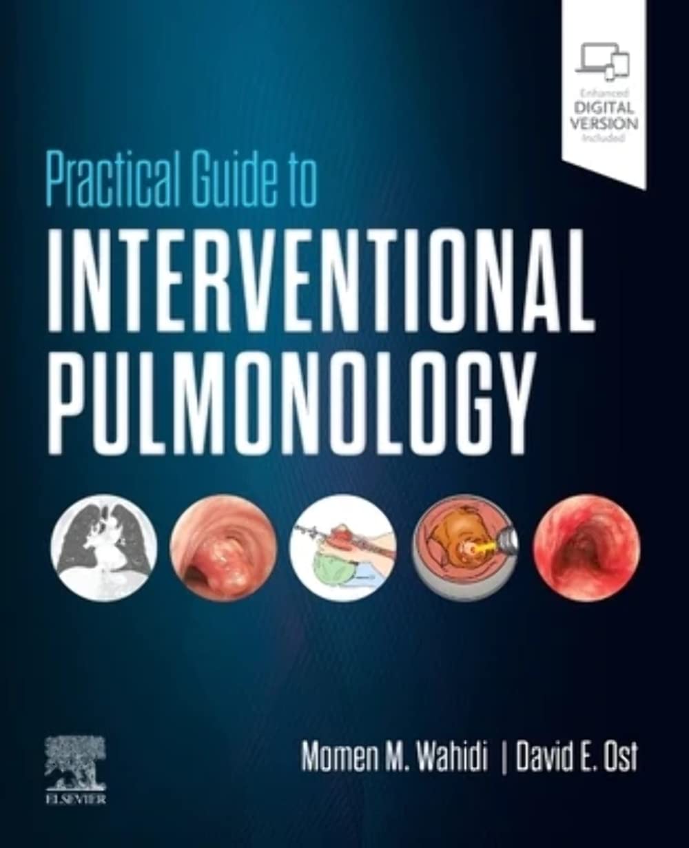 Practical Guide to Interventional Pulmonology: 1st Edition