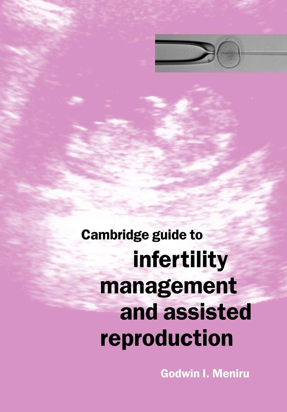 Cambridge Guide to Infertility Management and Assisted Reproduction: 1st Edition