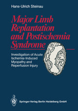 Major Limb Replantation and Postischemia Syndrome: Investigation of Acute Ischemia-Induced Myopathy and Reperfusion Injury