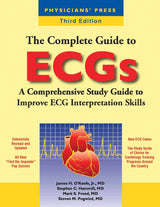 The Complete Guide to ECGs:.