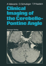 Clinical Imaging of the Cerebello-Pontine Angle: 1st Edition