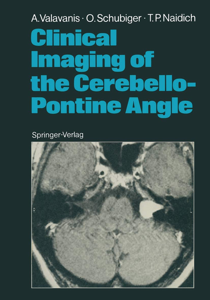 Clinical Imaging of the Cerebello-Pontine Angle: 1st Edition